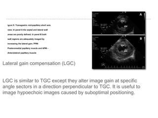 igure 9: Transgastric mid-papillary short axis
view. In panel A the septal and lateral wall
areas are poorly defined. In panel B both
wall regions are adequately imaged by
increasing the lateral gain. PPM-
Posteromedial papillary muscle and APM -
Anterolateral papillary muscle
Lateral gain compensation (LGC)
LGC is similar to TGC except they alter image gain at specific
angle sectors in a direction perpendicular to TGC. It is useful to
image hypoechoic images caused by suboptimal positioning.
 
