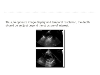 Thus, to optimize image display and temporal resolution, the depth
should be set just beyond the structure of interest.
 