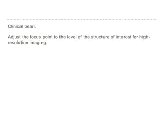 Clinical pearl.
Adjust the focus point to the level of the structure of interest for high-
resolution imaging.
 