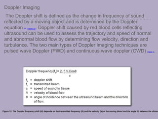 Doppler Imaging
The Doppler shift is defined as the change in frequency of sound
reflected by a moving object and is determined by the Doppler
equation [28] [Figure 12]. Doppler shift caused by red blood cells reflecting
ultrasound can be used to assess the trajectory and speed of normal
and abnormal blood flow by determining flow velocity, direction and
turbulence. The two main types of Doppler imaging techniques are
pulsed wave Doppler (PWD) and continuous wave doppler (CWD) [Table 1].
Figure 12: The Doppler frequency shift (fd) depends on the transmitted frequency (ft) and the velocity (V) of the moving blood and the angle (θ) between the ultraso
 