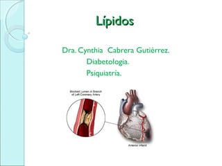 LípidosLípidos
Dra. Cynthia Cabrera Gutiérrez.
Diabetologia.
Psiquiatría.
 
