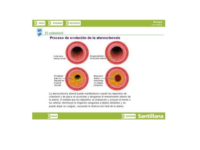 [i] El colesterol
Proceso do evolución do la atorosclorosis

Code le is
¡nula neural

El nlhill
¡me n
¡gala en
la pared

 ...