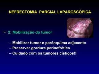 NEFRECTOMIA  PARCIAL LAPAROSCÓPICA 2: Mobilização do tumor Mobilizar tumor e parênquima adjacente Preservar gordura perinefrética Cuidado com os tumores císticos!! 