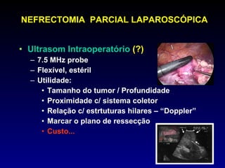 NEFRECTOMIA  PARCIAL LAPAROSCÓPICA Ultrasom Intraoperatório   (?) 7.5 MHz probe Flexível, estéril Utilidade: Tamanho do tumor / Profundidade Proximidade c/ sistema coletor Relação c/ estrtuturas hilares – “Doppler” Marcar o plano de ressecção Custo... 