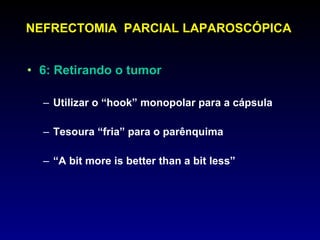 NEFRECTOMIA  PARCIAL LAPAROSCÓPICA 6: Retirando o tumor Utilizar o “hook” monopolar para a cápsula Tesoura “fria” para o parênquima “ A bit more is better than a bit less” 
