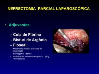 NEFRECTOMIA  PARCIAL LAPAROSCÓPICA Adjuvantes  Cola de Fibrina Bisturí de Argônio Floseal: Mecanismo: facilitar a cascata de coagulação Fibrinogênio   fibrina Grânulos em  contato c/ sangue     “plug “ hemostático 