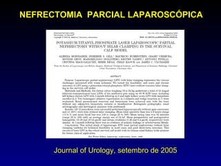 NEFRECTOMIA  PARCIAL LAPAROSCÓPICA  Journal of Urology, setembro de 2005 