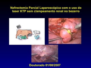 Nefrectomia Parcial Laparoscópica com o uso do laser KTP sem clampeamento renal no bezerro Doutorado 01/08/2007 