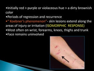 •Initially red > purple or violaceous hue > a dirty brownish
color
•Periods of regression and recurrence
•“ Koebner’s phenomenon”- skin lesions extend along the
areas of injury or irritation (ISOMORPHIC RESPONSE)
•Most often on wrist, forearms, knees, thighs and trunk
•Face remains uninvolved
 