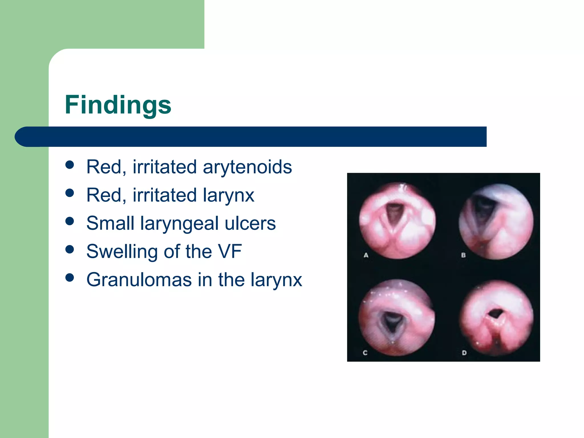 Findings

   Red, irritated arytenoids
   Red, irritated larynx
   Small laryngeal ulcers
   Swelling of the VF
   Granulomas in the larynx
 