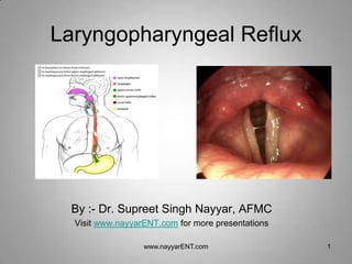 Laryngopharyngeal Reflux




 By :- Dr. Supreet Singh Nayyar, AFMC
  Visit www.nayyarENT.com for more presentations

                  www.nayyarENT.com                1
 