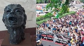 "Luteal Phase Support"