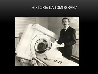 HISTÓRIA DA TOMOGRAFIA
 