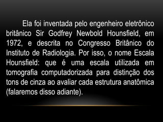 Ela foi inventada pelo engenheiro eletrônico
britânico Sir Godfrey Newbold Hounsfield, em
1972, e descrita no Congresso Britânico do
Instituto de Radiologia. Por isso, o nome Escala
Hounsfield: que é uma escala utilizada em
tomografia computadorizada para distinção dos
tons de cinza ao avaliar cada estrutura anatômica
(falaremos disso adiante).
 