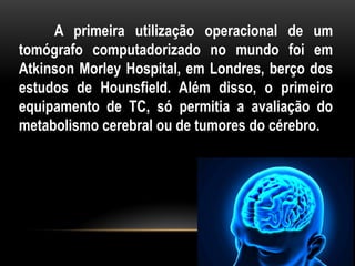 A primeira utilização operacional de um
tomógrafo computadorizado no mundo foi em
Atkinson Morley Hospital, em Londres, berço dos
estudos de Hounsfield. Além disso, o primeiro
equipamento de TC, só permitia a avaliação do
metabolismo cerebral ou de tumores do cérebro.
 