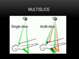 MULTISLICE
 
