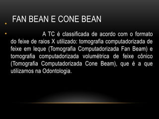 FAN BEAN E CONE BEAN
•
• A TC é classificada de acordo com o formato
do feixe de raios X utilizado: tomografia computadorizada de
feixe em leque (Tomografia Computadorizada Fan Beam) e
tomografia computadorizada volumétrica de feixe cônico
(Tomografia Computadorizada Cone Beam), que é a que
utilizamos na Odontologia.
 