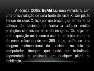 A técnica CONE BEAM faz uma varredura, com
uma única rotação de uma fonte de raios X. Um pistão
sensor de raios X, fixo por um braço, gira em torno da
cabeça do paciente de forma a adquirir muitas
projeções simples ou base de imagens. Ou seja: em
uma exposição única com o uso de um feixe em forma
de cone, rotacionando em 360 graus, obtém-se uma
imagem tridimensional do paciente na tela do
computador, imagem que pode ser trabalhada,
segmentada e analisada em qualquer plano ou
incidência.
 