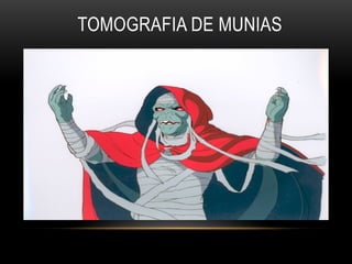 TOMOGRAFIA DE MUNIAS
 