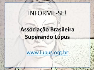 INFORME-SE!
Associação Brasileira
Superando Lúpus
www.lupus.org.br
 