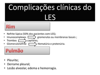 • Nefrite lúpica (50% dos pacientes com LES);
• Imunocomplexos gromerulos ou membranas basais ;
• Trombos capilares;
• Glomerulonefrite Hematúria e protenúria.
• Pleurite;
• Derrame pleural;
• Lesão alveolar, edema e hemorragia.
Complicações clínicas do
LES
 