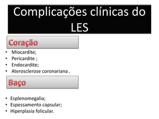• Miocardite;
• Pericardite ;
• Endocardite;
• Aterosclerose coronariana .
• Esplenomegalia;
• Espessamento capsular;
• Hiperplasia folicular.
Complicações clínicas do
LES
 