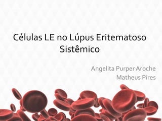 Células LE no Lúpus Eritematoso
Sistêmico
Angelita PurperAroche
Matheus Pires
 