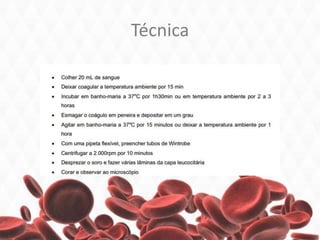 Técnica
 