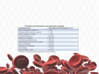 Exames Laboratoriais - Autoanticorpos, SANTOS V T - Coordenadora da Unidade de Imunologia Humoral II do Laboratório de
Investigação Médica da Disciplina de Reumatologia da Faculdade de Medicina da Universidade de São Paulo
 