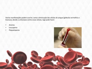 Outras manifestações podem ocorrer, como a diminuição das células do sangue (glóbulos vermelhos e
brancos), devido a anticorpos contra essas células, logo pode haver:
• Anemia
• Leucopenia
• Plaquetopenia
 