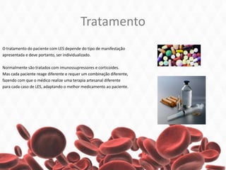 Tratamento
O tratamento do paciente com LES depende do tipo de manifestação
apresentada e deve portanto, ser individualizado.
Normalmente são tratados com imunossupressores e corticoides.
Mas cada paciente reage diferente e requer um combinação diferente,
fazendo com que o médico realize uma terapia artesanal diferente
para cada caso de LES, adaptando o melhor medicamento ao paciente.
 