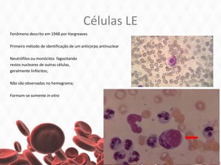 Células LE
Fenômeno descrito em 1948 por Hargreaves
Primeiro método de identificação de um anticorpo antinuclear
Neutrófilos ou monócitos fagocitando
restos nucleares de outras células,
geralmente linfócitos;
Não são observadas no hemograma;
Formam-se somente in vitro
 