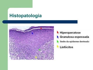 Histopatologia
 