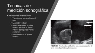 Técnicas de
medición sonográfica
• Artefacto de reverberación
• Transductor perpendicular al
piso.
• Medición vertical
• Borde interno de la pared
uterina anterior al borde
interno de la pared uterina
posterior.
• Reverberancia vs. pared
uterina
 