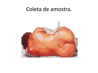 Coleta de amostra.
 