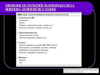 SÍNDROME DE SECRESIÓN INAPROPIADA DE LA HORMONA ANTIDIURÉTICA (SIADH) 