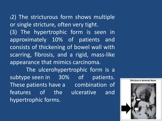 (2) The stricturous form shows multiple
or single stricture, often very tight.
(3) The hypertrophic form is seen in
approximately 10% of patients and
consists of thickening of bowel wall with
scarring, fibrosis, and a rigid, mass-like
appearance that mimics carcinoma.
The ulcerohypertrophic form is a
subtype seen in 30% of patients.
These patients have a combination of
features of the ulcerative and
hypertrophic forms.
 