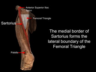 The medial border of
Sartorius forms the
lateral boundary of the
Femoral Triangle
Patella
Sartorius
Anterior Superior Iliac
Spine
Femoral Triangle
 