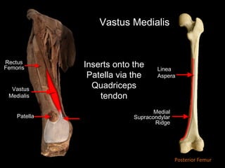 Linea
Aspera
Medial
Supracondylar
Ridge
Vastus
Medialis
Patella
Inserts onto the
Patella via the
Quadriceps
tendon
Posterior Femur
Rectus
Femoris
Vastus Medialis
 