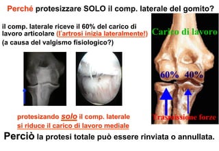 Perché protesizzare SOLO il comp. laterale del gomito?
il comp. laterale riceve il 60% del carico di
lavoro articolare (l artrosi inizia lateralmente!)
(a causa del valgismo fisiologico?)

protesizando solo il comp. laterale
si riduce il carico di lavoro mediale

Perciò la protesi totale può essere rinviata o annullata.

 
