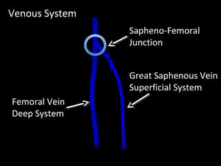 Great Saphenous Vein
Superficial System
Femoral Vein
Deep System
Sapheno-Femoral
Junction
Venous System
 