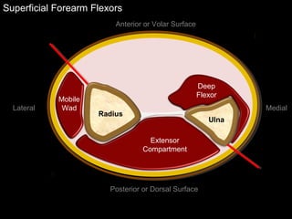 Superficial Forearm Flexors
Anterior or Volar Surface
Posterior or Dorsal Surface
Lateral Medial
Ulna
Radius
Extensor
Compartment
Deep
Flexor
Mobile
Wad
 