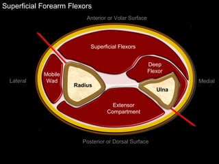 Superficial Forearm Flexors
Anterior or Volar Surface
Posterior or Dorsal Surface
Lateral Medial
Ulna
Radius
Extensor
Compartment
Deep
Flexor
Superficial Flexors
Mobile
Wad
 