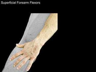 Superficial Forearm Flexors
 