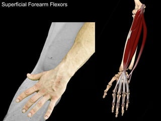 Superficial Forearm Flexors
 