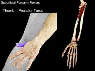 Superficial Forearm Flexors
Thumb = Pronator Teres
 