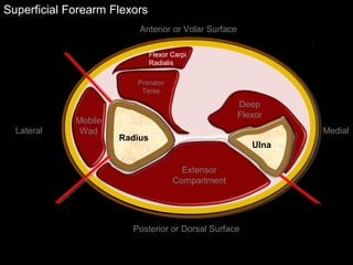 Superficial Forearm Flexors
Ulna
Radius
Mobile
Wad
Deep
Flexor
Flexor Carpi
Radialis
Pronator
Teres
Extensor
Compartment
Anterior or Volar Surface
Posterior or Dorsal Surface
Lateral Medial
 