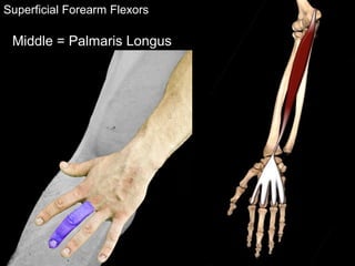Superficial Forearm Flexors
Middle = Palmaris Longus
 