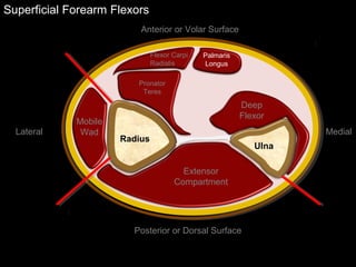 Superficial Forearm Flexors
Ulna
Radius
Extensor
Compartment
Mobile
Wad
Deep
Flexor
Flexor Carpi
Radialis
Palmaris
Longus
Pronator
Teres
Anterior or Volar Surface
Posterior or Dorsal Surface
Lateral Medial
 
