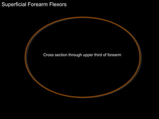 Superficial Forearm Flexors
Cross section through upper third of forearm
 